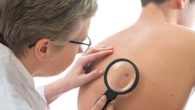 Skin Cancer Diagnosis & Treatment